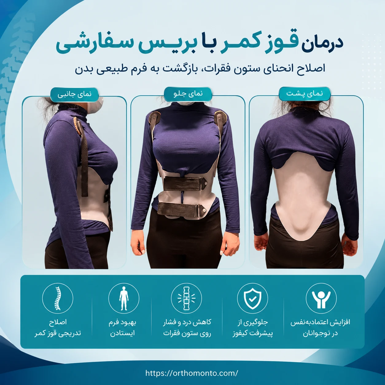 درمان قوز کمر