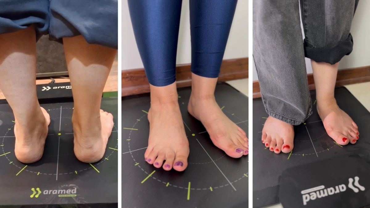 اسکن سه بعدی کف پا