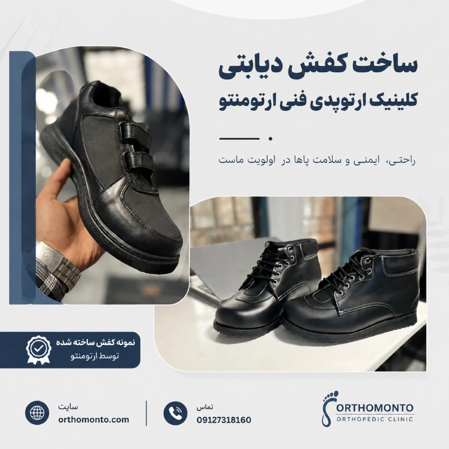 ساخت کفش دیابتی