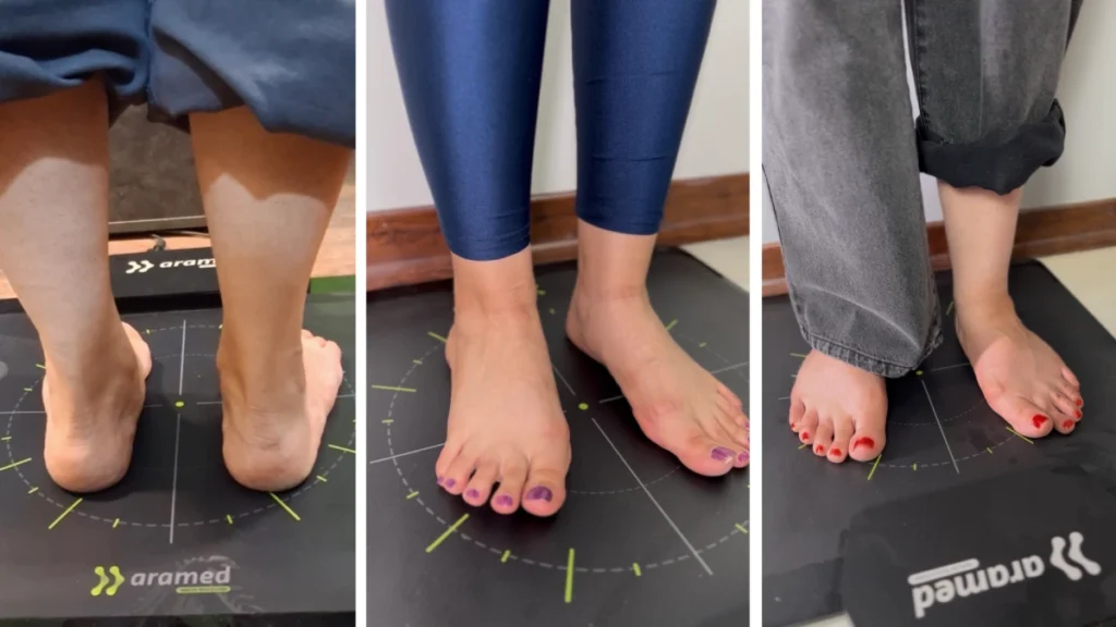 اسکن سه بعدی کف پا